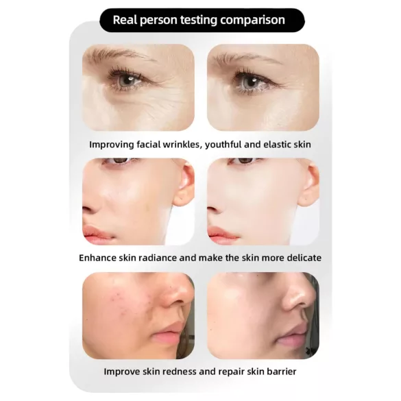 Фотонски подмлађујући ЛЕД маска за лице